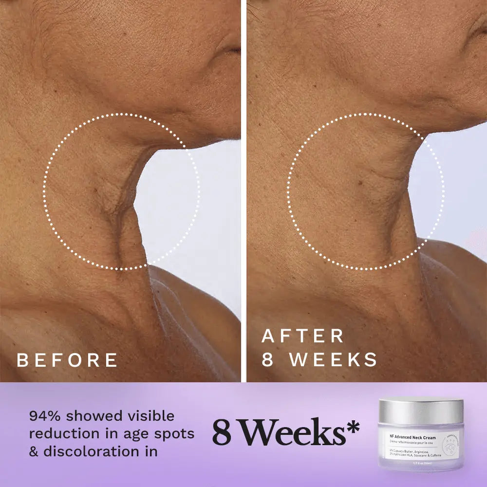 NF Advanced Neck Cream